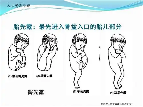胎姿势胎产式胎先露胎方位90646