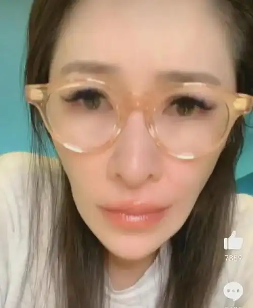 萧亚轩近况曝光,脸颊凹陷下巴尖额头凸起,十分怪异惹人担忧