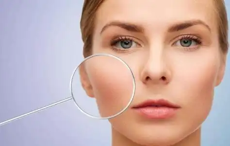 毛孔粗大太尴尬!邢台媚思嘉美容美发学校教你几招收缩毛孔!