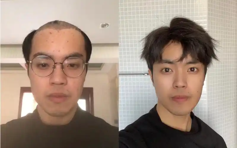 90后秃头小伙戴上假发减龄5岁,发型教程分享