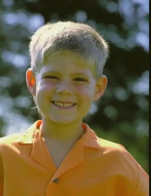 小孩子头发白,该怎么治?