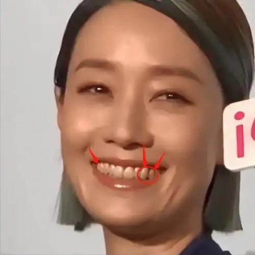 网友:太恶心了|马伊琍|牙齿_网易订阅