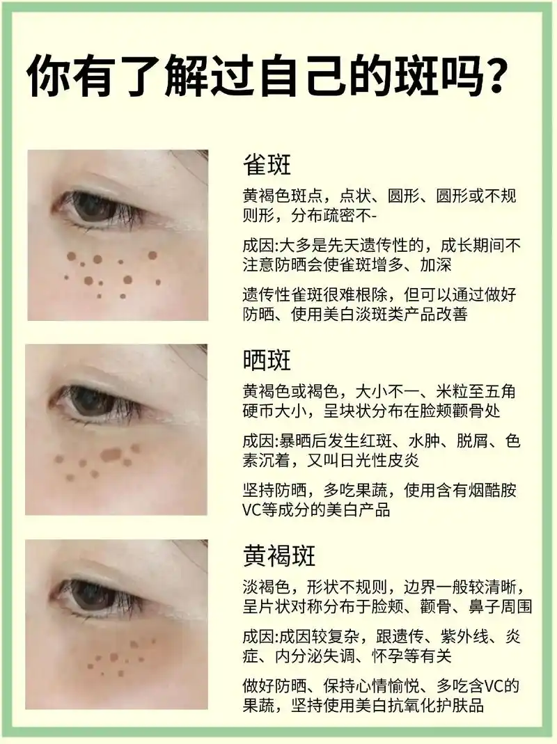 只有清晰了解自己的斑点,才可以好的改善.