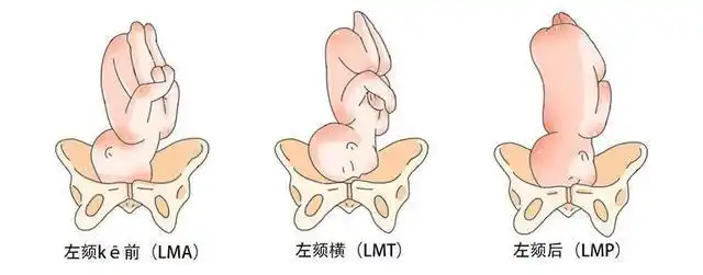 对胎位的描述loaroalsa是
