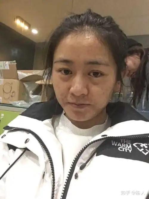 五官好看,皮肤差是种怎样的体验?