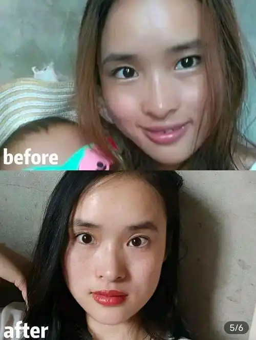 黑黄皮的夏日美白攻略!多年皮肤管理,我终于变白了!