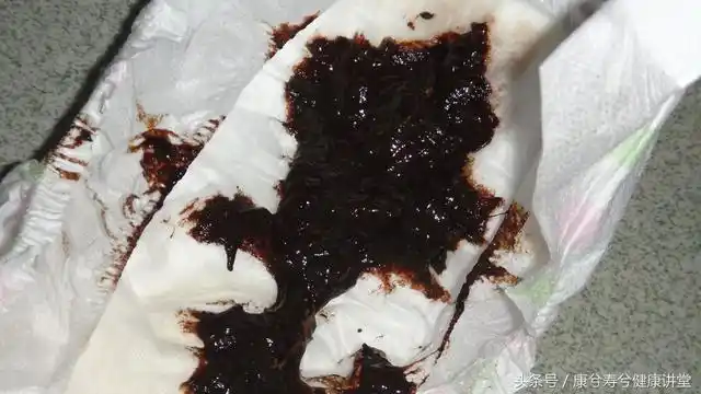 23岁女生胃痛一月,查出胃癌,这些情况再不注意就晚了