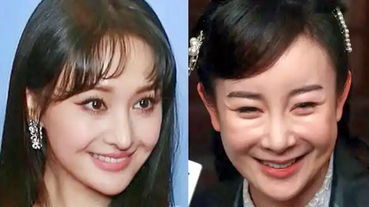 11位自曝整容的女星,郑爽鼻子像女巫,张檬整容失败令人心疼!