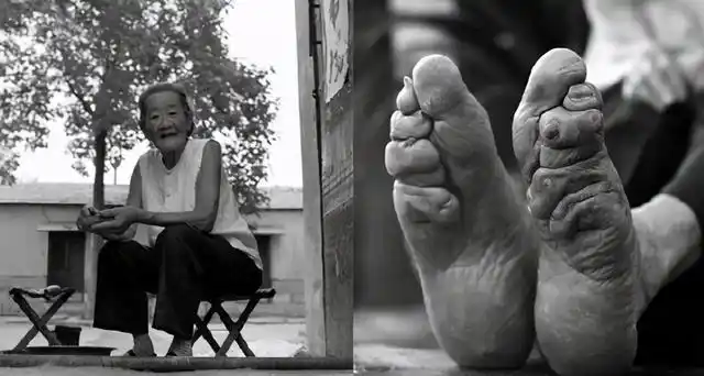 裹脚:5岁女孩大哭三天三夜,"三寸金莲"成了嫁人的敲门砖