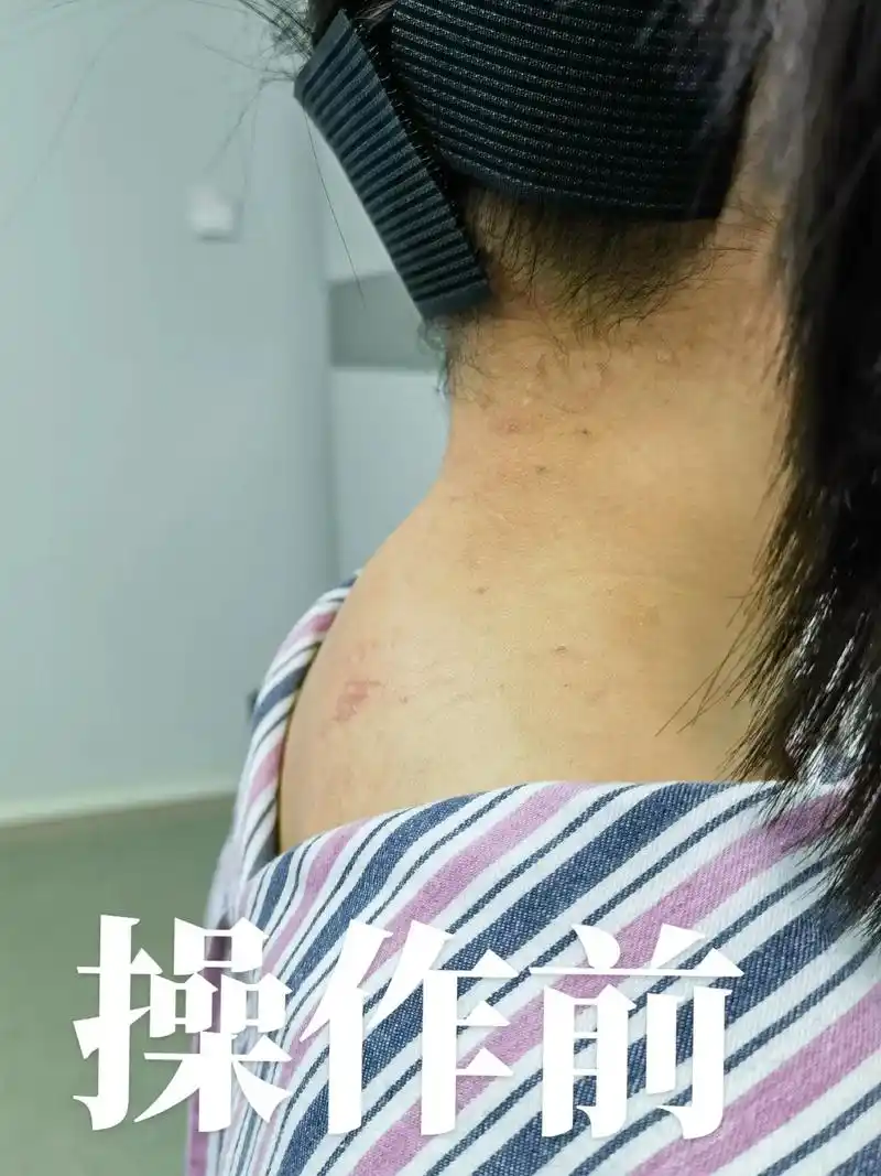 脖子前倾 #低头族 #肩颈酸痛 # - 抖音