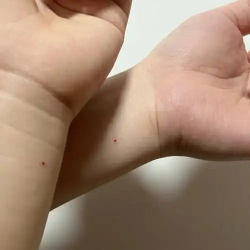 和老公一起去纹了小红点听说 有相同朱砂痣的人下辈子还能遇到( 误打