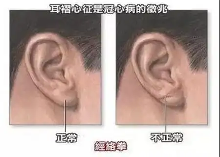 长寿的人是个什么面相 来看看自己符合几条吧