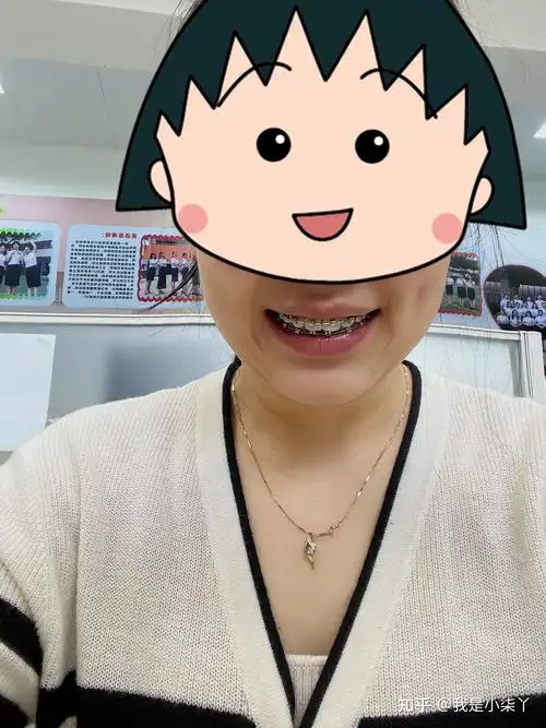 28岁小龅牙的整牙之旅 - 知乎