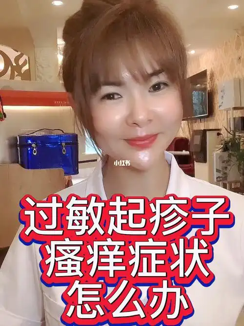 皮肤过敏爆皮起疹子瘙痒难耐怎么办