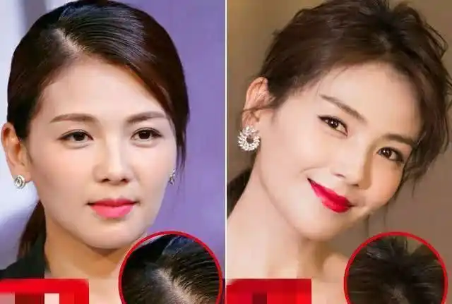 娱乐圈的女明星对发量的需求更是大,因此,想办法增加自己的发量是这些