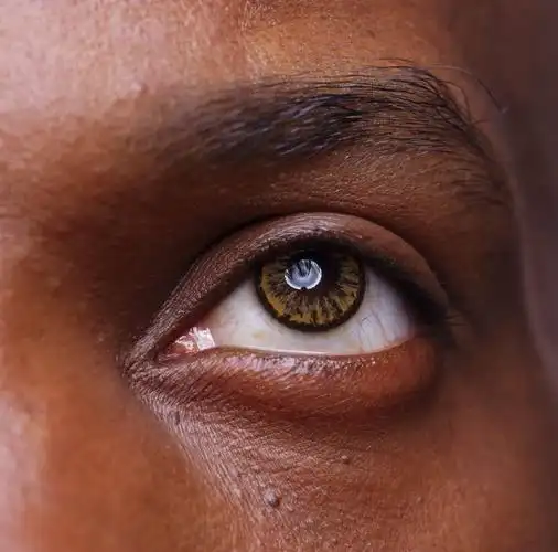 求一张单眼的图片,最好是真实的眼睛,不是二次的,左右眼无所谓,最好给