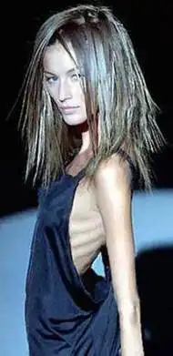 英女孩为减肥瘦成"骷髅"[图]