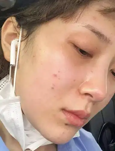 以前很少过敏,一换季皮肤就不好了,哪里做错了?