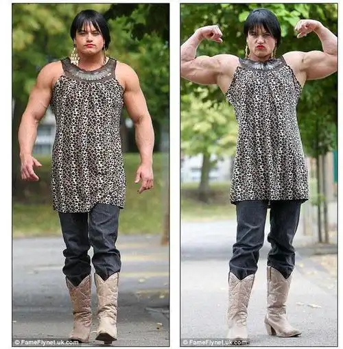 后悔已经晚了!28岁女子滥用类固醇药物变成肌肉猛男