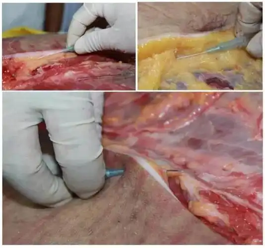 没有解剖学就没有医学——2019年1月12日全国第十一届深圳新鲜尸体