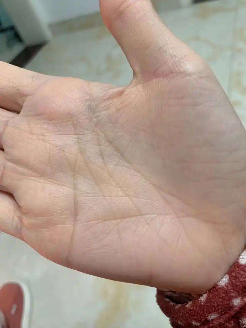 四条线的手掌纹 有比我更奇特的吗?手掌纹 关于算命 手掌纹算命