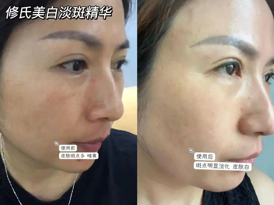 美白淡斑精华使用反馈90 原相机91实拍,主打就是真实!