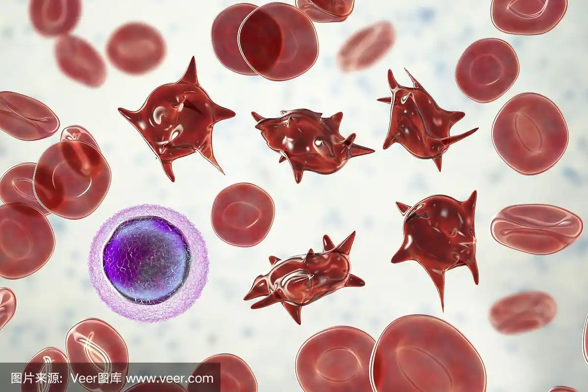 棘细胞,有刺状突起的异常红细胞
