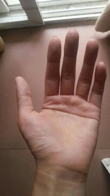 男生左手是断掌,这样的人,命好吗?