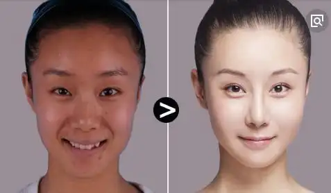 图二图三是她吃美白丸半个月的对比