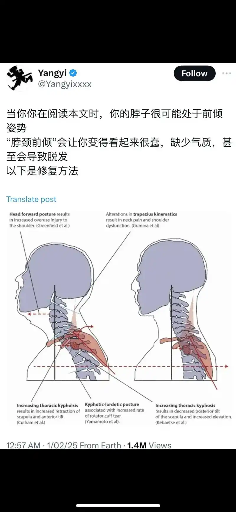脖颈前倾的危害与修复