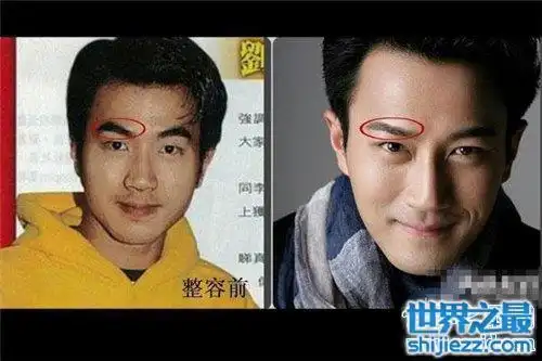 刘恺威整容前后对比照 现在的刘恺威更具有男人味