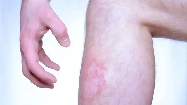 双腿与身体健康有什么关系?