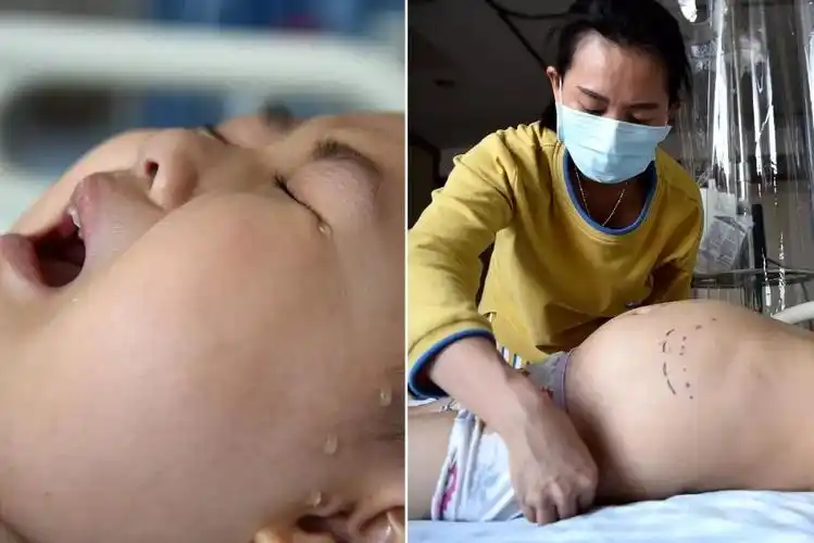 7岁女孩肚大如有8月身孕每天喊疼妈妈心碎