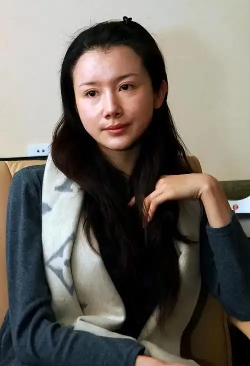 孙菲菲:曾经热衷于整容,被医美坑惨的她,现在终于明白了!