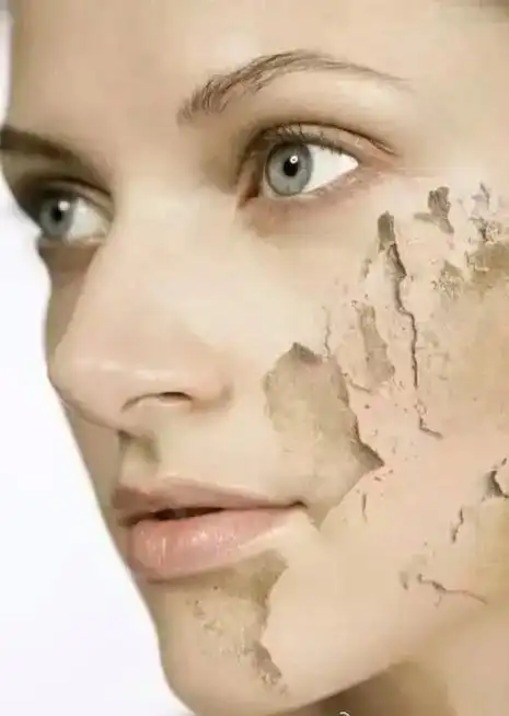 肌肤缺水4宗罪:1,皮肤敏感:肌肤干燥,通常皮脂膜不完整,导 - 抖音