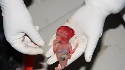 怀孕4月,却被家人要求引产,原因让人气愤