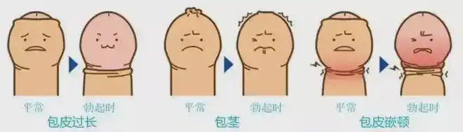 买了住院医疗险去做包皮包茎手术能不能报销