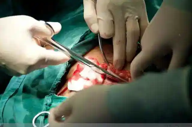 百张照片再现剖腹产全程 妈妈真的太伟大了(组图)