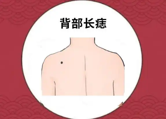 背部长痣在相学当中,若是一个人的背部的位置处长有恶痣,则属于天生的