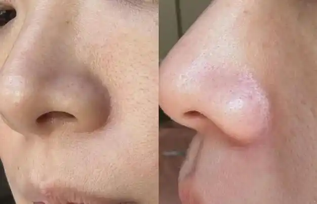 美白|毛孔|眼膜|黑眼圈|敏感肌肤_网易订阅