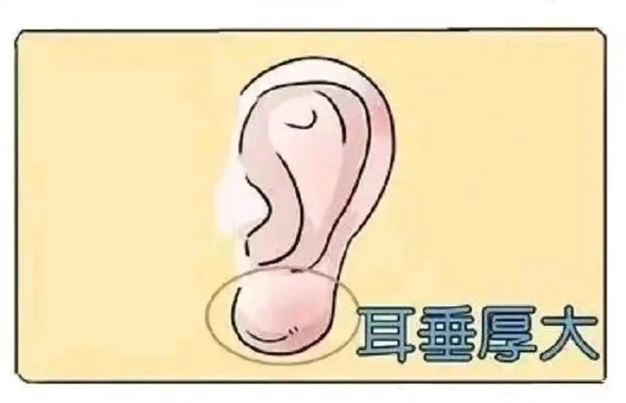 耳垂厚大.
