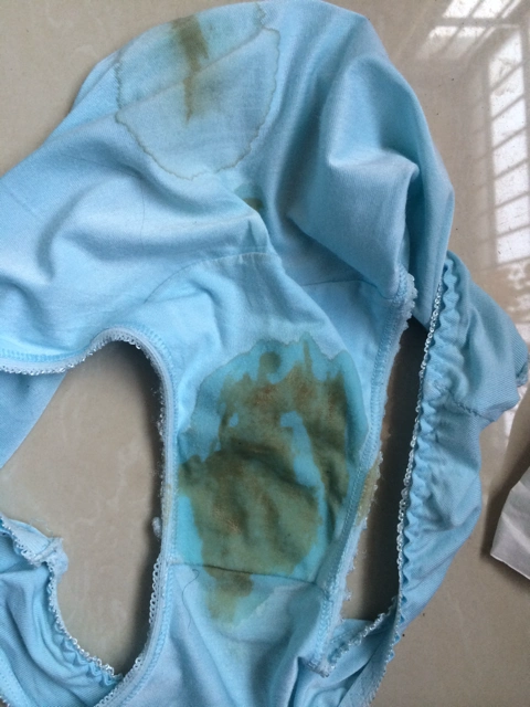 现在才35周多点,今天早上起来发现内裤上好像是血一样.