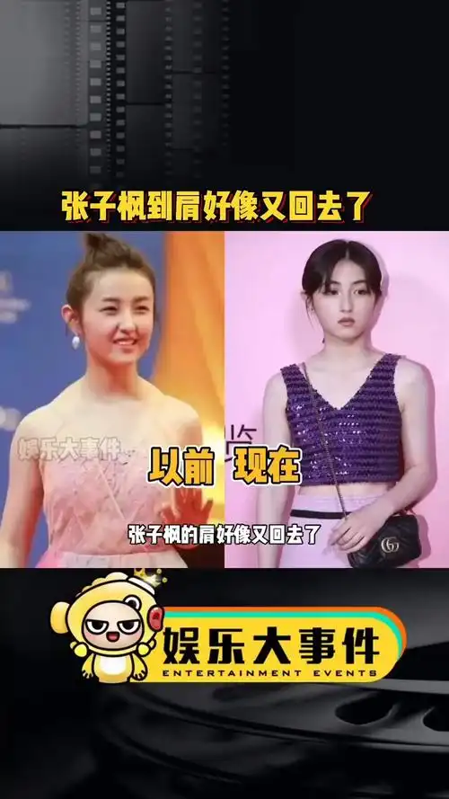 张子枫的肩好像又回去了,从斜方肌明显,到突变直角肩,现在整个人都变