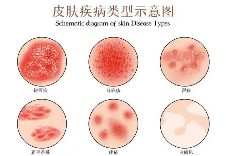 揭秘:除了有"夫妻相"还有"夫妻病"