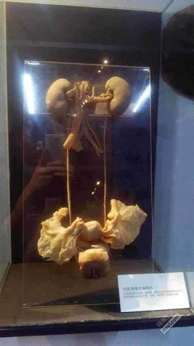 别人去汉阳造踏青,我看人体标本展!