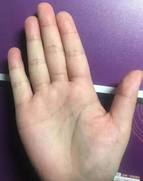 整体手相不错,后期事业,财运姻缘都没啥大的问题.