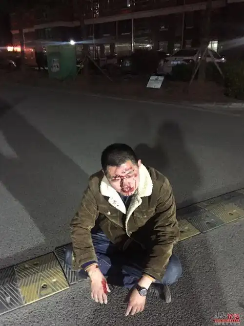 峰汇国际物业打人真相有图片为证