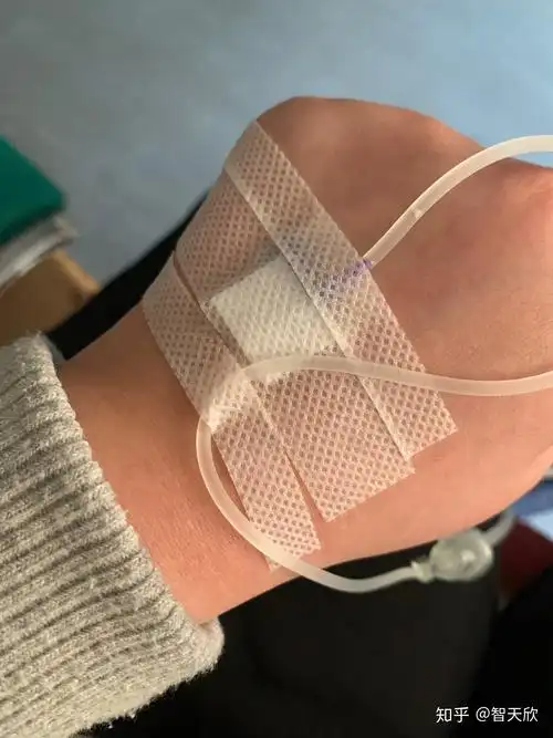 有没有输液的照片我给老师请的病假她要我发照片给她