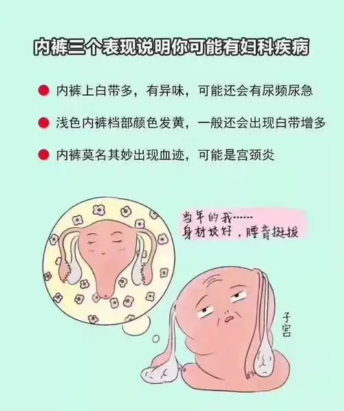 妇科支原体感染症状和治疗方法-精准抗艾-互联网艾滋病性病预防诊疗