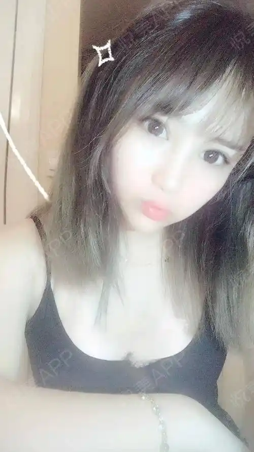 假体隆胸术后14天_隆胸术后14天_胸部整形术后14天_颜值精选术后14天